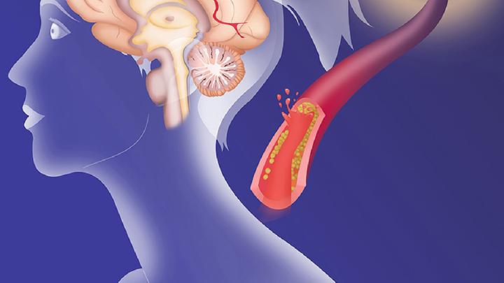 味觉是五脏六腑的“风向标”？不同滋味对应着不同疾病！